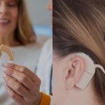 کاشت حلزون شنوایی