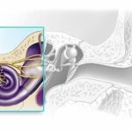 کاهش شنوایی مختلط