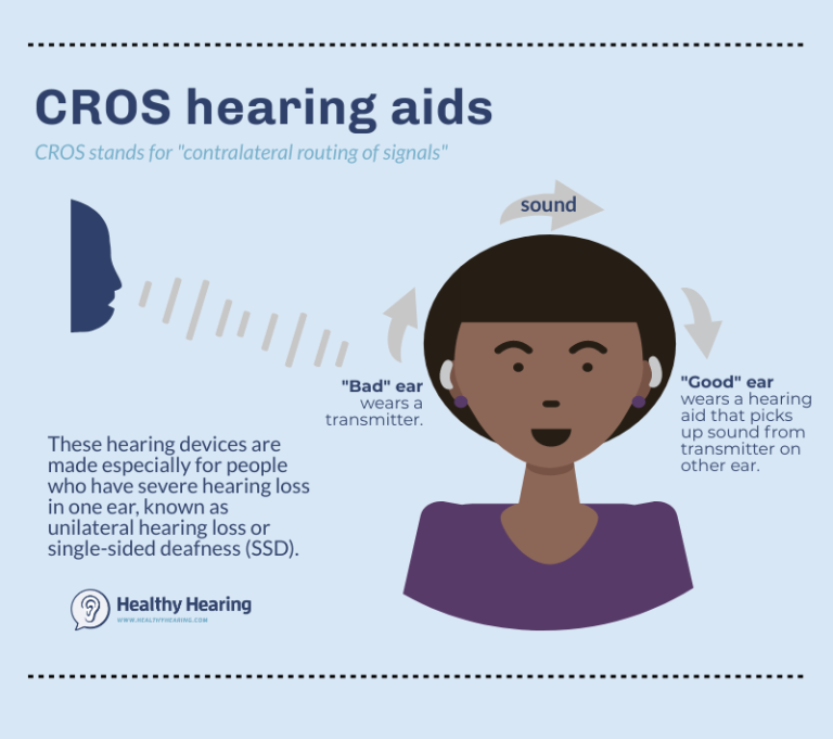 CROS و BiCROS چه نوع سمعک‌هایی هستند؟