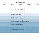 درجات مختلف کم‌شنوایی